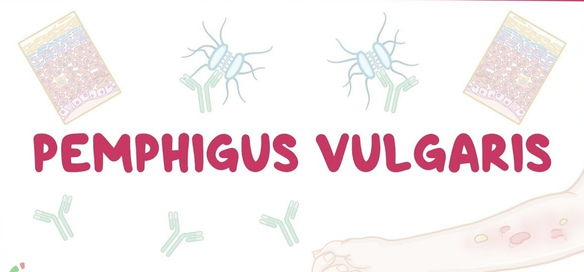 What is Pemphigus Vulgaris?