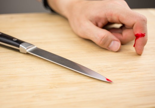 How to manage a patient with Knife Cut