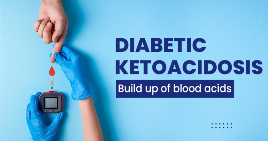 Diabetic Ketoacidosis (DKA): Etiology, Clinical features & Treatment