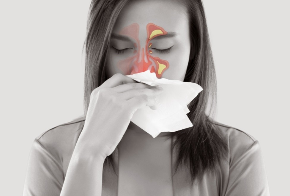 Sinus Infection (Sinusitis): Causes, Symptoms, Evaluation & Treatment