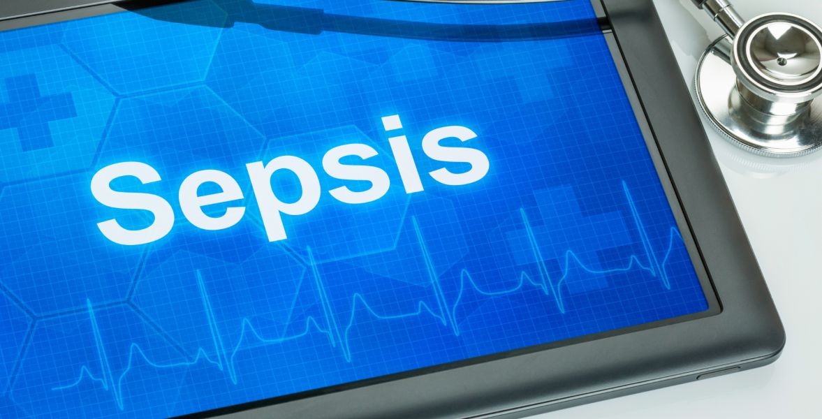 How to Evaluate Sepsis